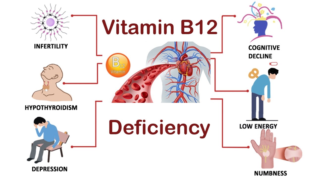 b12 deficiency