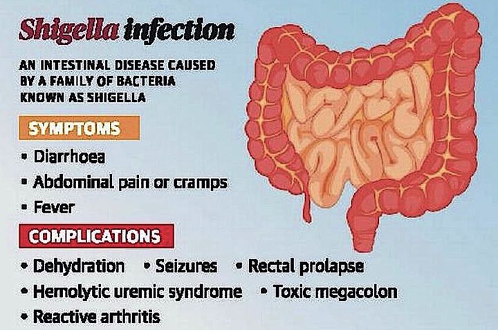 shigella infection