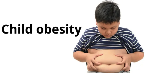 obesity in children