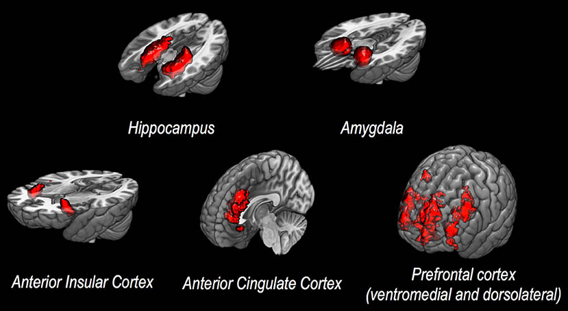 changes in brain